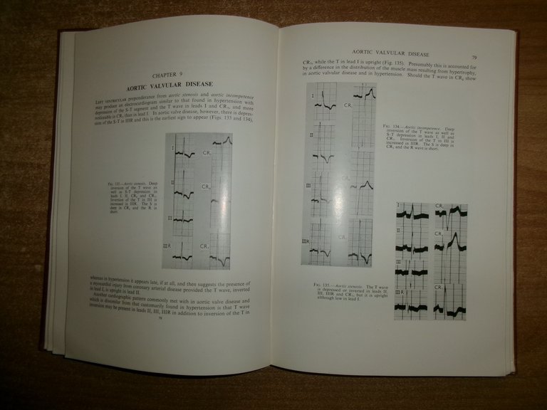 CARDIOGRAPHY Second Edition. By WILLIAM EVANS 1954