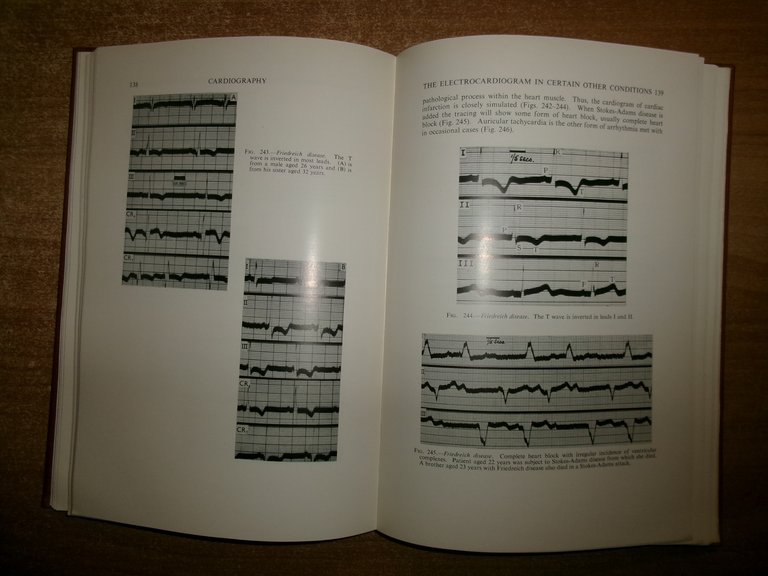 CARDIOGRAPHY Second Edition. By WILLIAM EVANS 1954