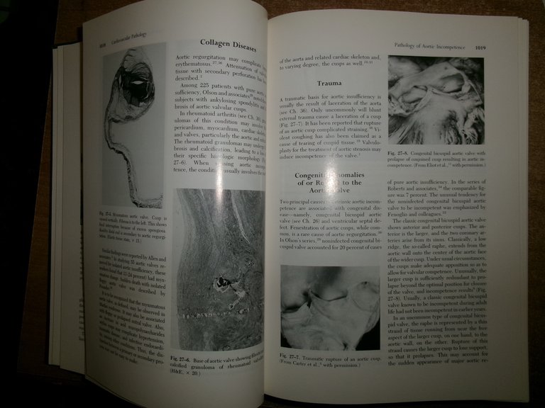 CARDIOVASCULAR PATHOLOGY Second Edition. Malcom D. Silver 2 volumi 1991