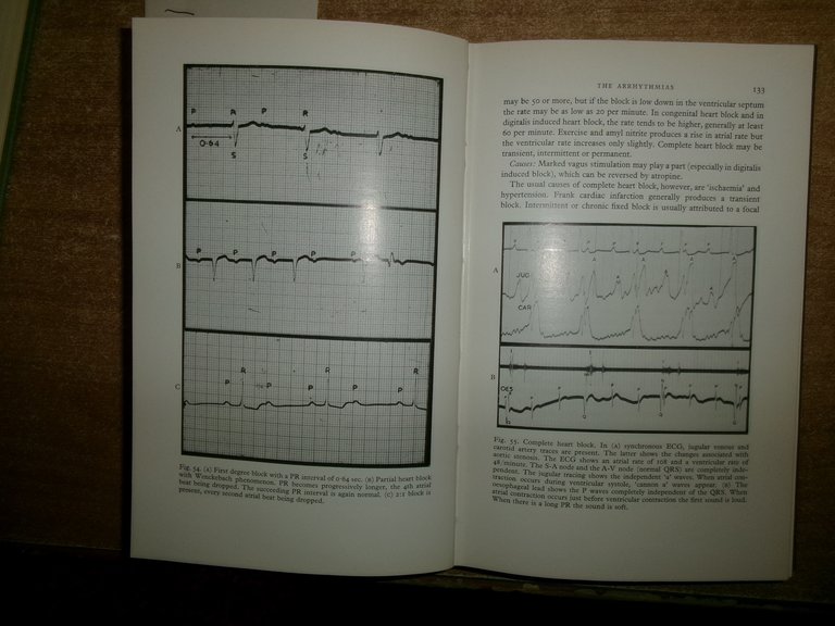 CLINICAL CARDIOLOGY - VELVA SCHRIRE 1963