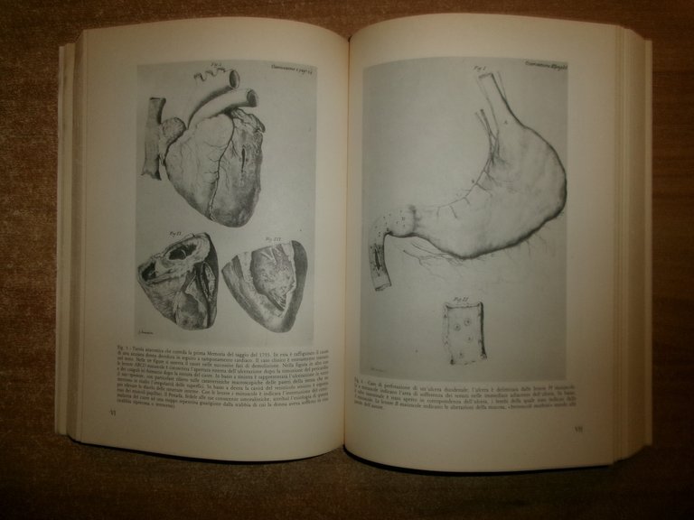 DE SEDIBUS, ET CAUSIS MORGAGNI NEL CENTENARIO. CAPPELLETTI/DI TROCCHIO 1986