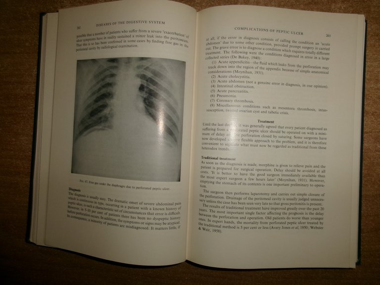 Diseases of the Digestive System. TRUELOVE - REYNELL 1963