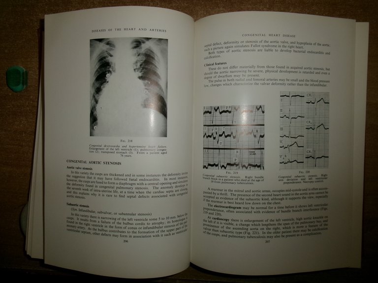 Diseases of The HEART and ARTERIES by WILLIAM EVANS 1964