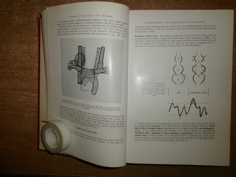 Diseases of The HEART and ARTERIES by WILLIAM EVANS 1964