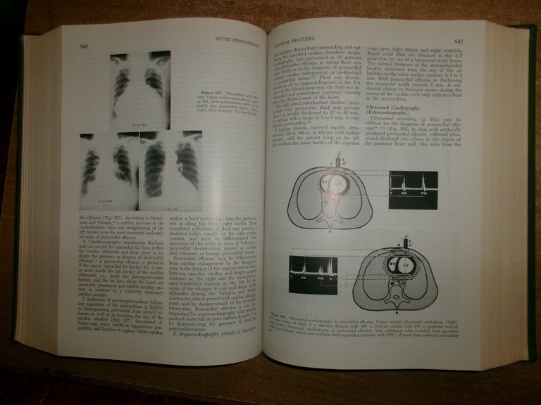 Diseases of the Heart. CHARLES K. FRIEDBERG 1966