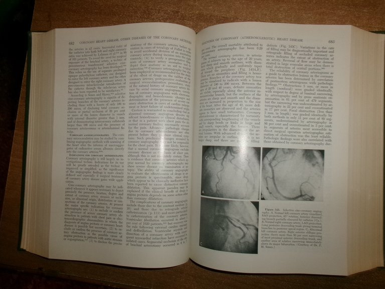 Diseases of the Heart. CHARLES K. FRIEDBERG 1966