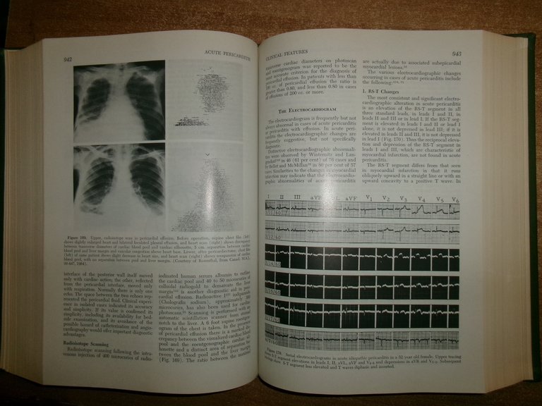 Diseases of the Heart. CHARLES K. FRIEDBERG 1966