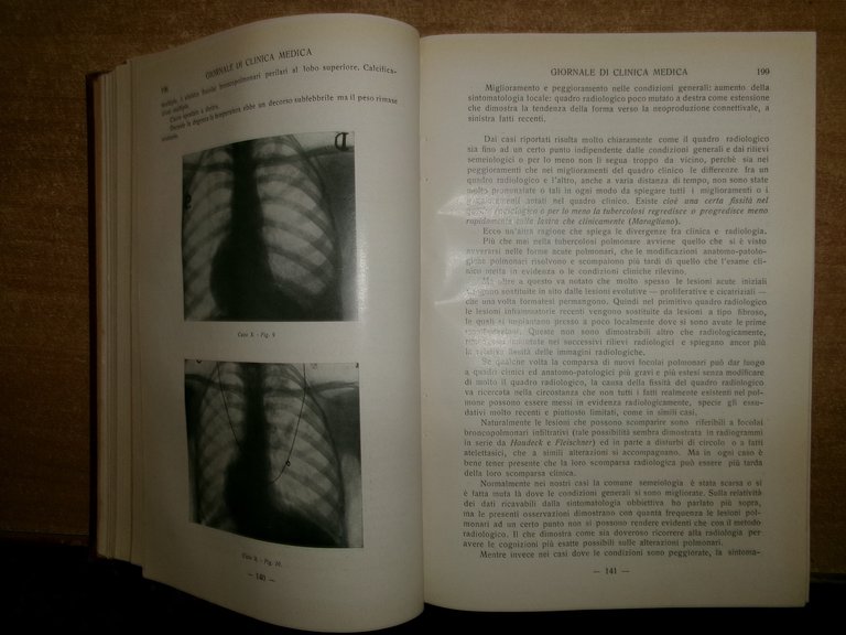 DOMENICO CAMPANACCI. Giornale di Clinica Medica 18 fascicoli legati assieme …