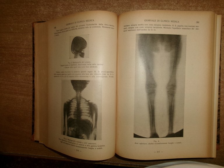 DOMENICO CAMPANACCI. Giornale di Clinica Medica 1943. 18 fascicoli legati …