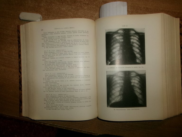 DOMENICO CAMPANACCI. Giornale di Clinica Medica 1953. 12 fascicoli legati …