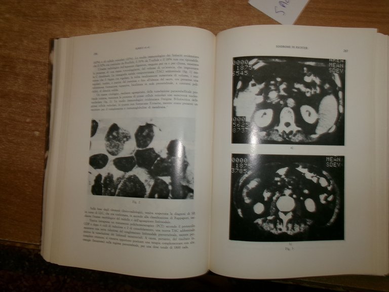 DOMENICO CAMPANACCI. Giornale di Clinica Medica 1984-12 fascicoli legati assieme