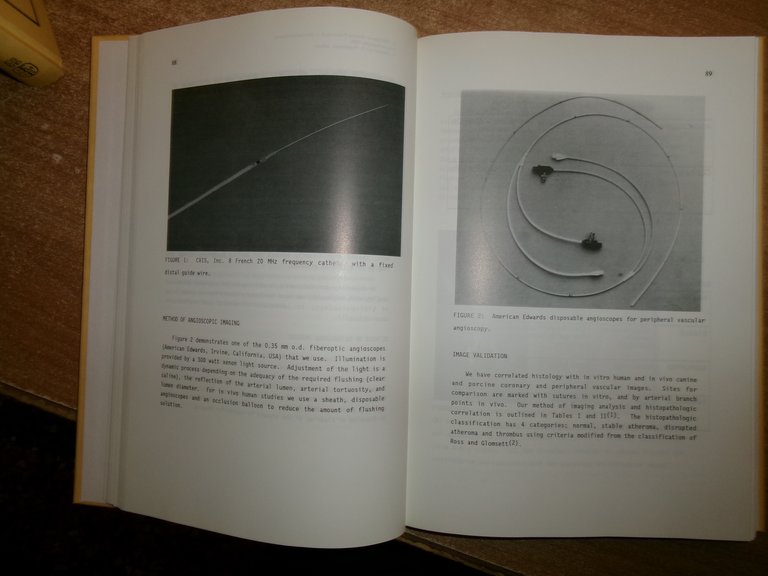 ECHO-CARDIOGRAPHY. A. DAGIANTI - H. FEIGENBAUM 1990 - 1993