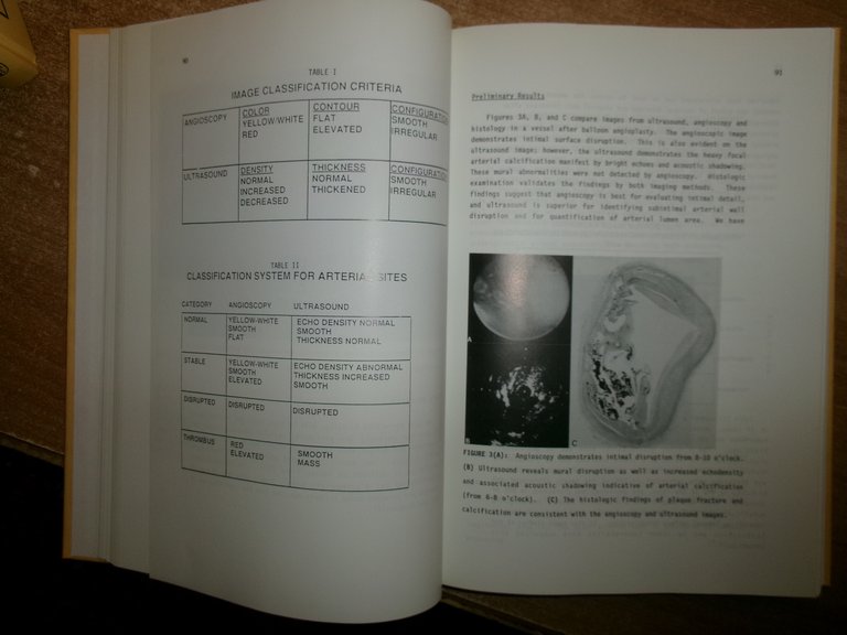 ECHO-CARDIOGRAPHY. A. DAGIANTI - H. FEIGENBAUM 1990 - 1993