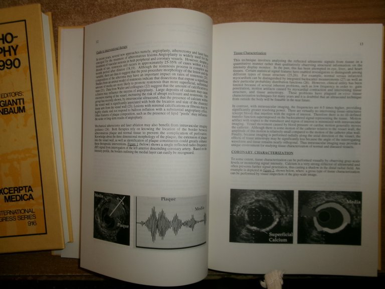 ECHO-CARDIOGRAPHY. A. DAGIANTI - H. FEIGENBAUM 1990 - 1993