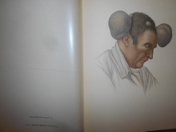 Entwicklung und Bibliographie der Pathologisch-Anatomischen Abbildung