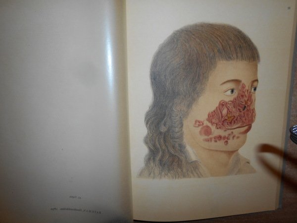 Entwicklung und Bibliographie der Pathologisch-Anatomischen Abbildung