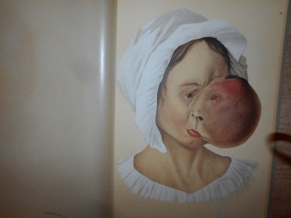 Entwicklung und Bibliographie der Pathologisch-Anatomischen Abbildung