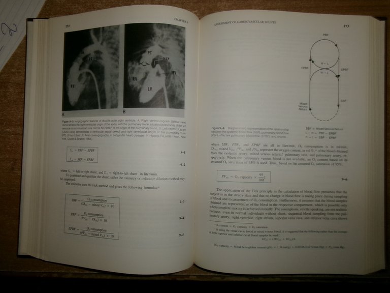 FROM CARDIAC CATHERIZATION DATA TO HEMODYNAMIC... BENTIVOGLIO-GOLDBERG 1988