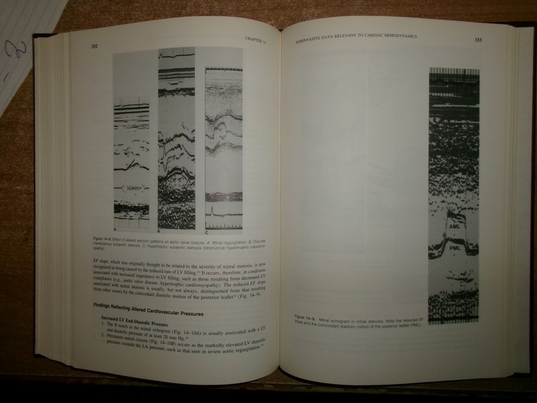 FROM CARDIAC CATHERIZATION DATA TO HEMODYNAMIC... BENTIVOGLIO-GOLDBERG 1988