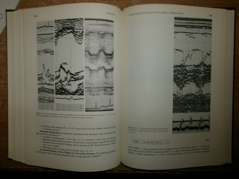 FROM CARDIAC CATHERIZATION DATA TO HEMODYNAMIC... BENTIVOGLIO-GOLDBERG 1988