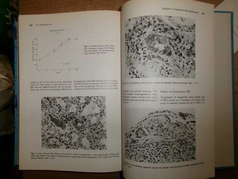 Frontiers in Hypertension Research. JOHN H. LARAGH - FRITZ BUHLER …