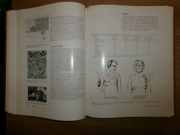 General Pathology Principles and Dynamics. WEST KING - M. FENOGLIO …