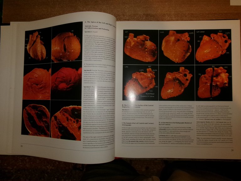 Heart and Coronary Arteries: An Anatomical Atlas for Clinical...WALLACE McALPINE