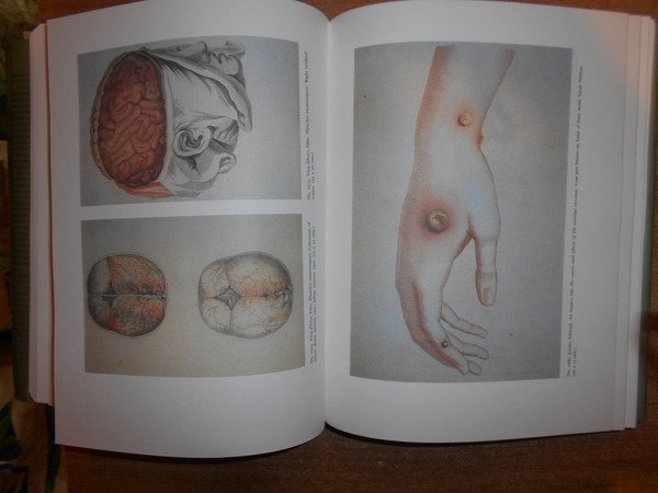 HEIRS OF HIPPOCRATES. The Development of Medicine in a Catalogue …
