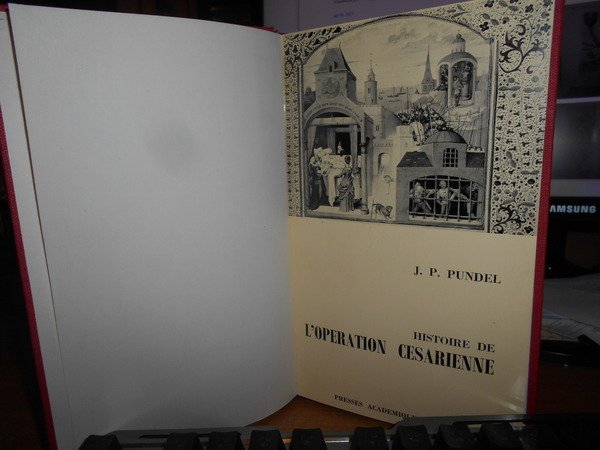 HISTOIRE de L' OPERATION CESARIENNE. Etude historique de la césarienne …
