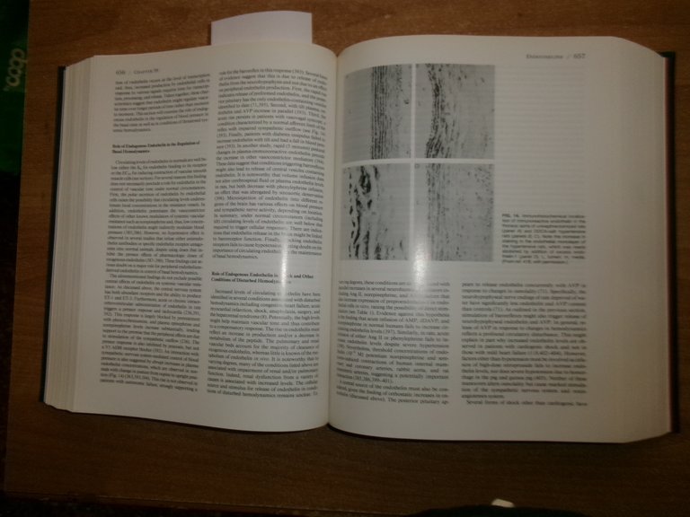 HYPERTENSION Pathophysiology, Diagnosis, and...Volume One LARAGH. BRENNER 1995