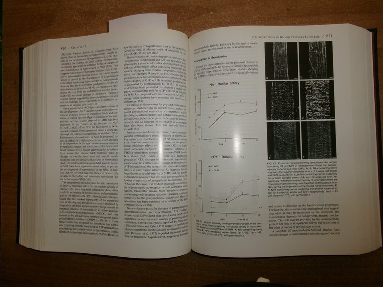 HYPERTENSION Pathophysiology, Diagnosis, and...Volume One LARAGH. BRENNER 1995