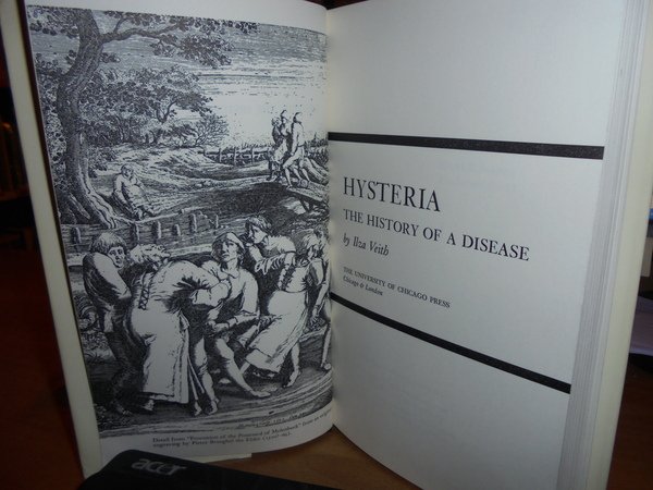 HYSTERIA The History of a disease