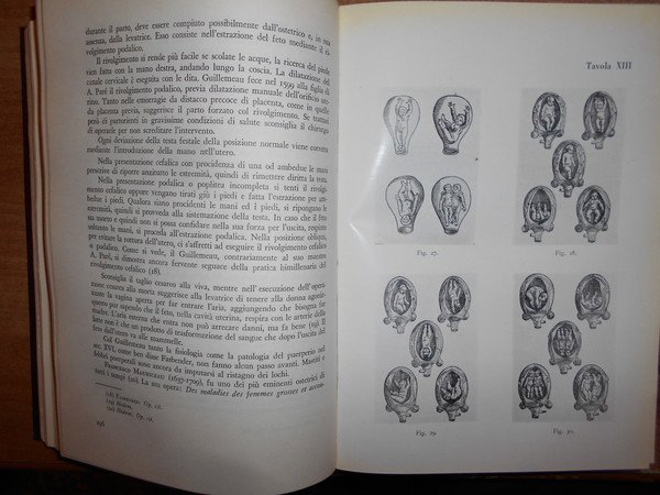 Il Pensiero Ostetrico-Ginecologico nei Secoli