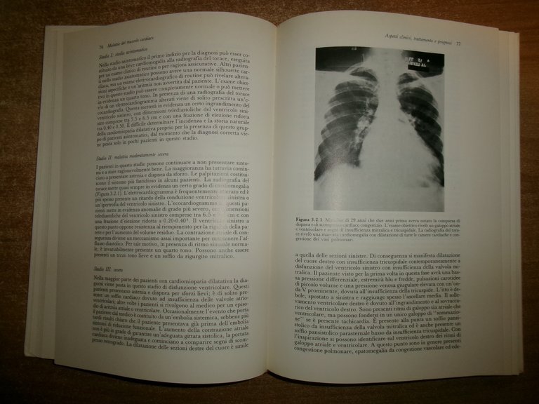 J. F. GOODWIN. Malattie del Muscolo Cardiaco 1987