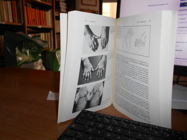 L. BONOMO. MALATTIE REUMATICHE. UTET, 1986