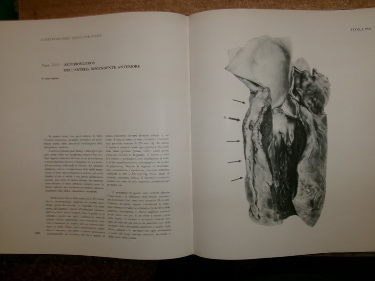 L'infarto miocardico. Inchiesta internazionale realizzata da Renzo Brusca. WHITE