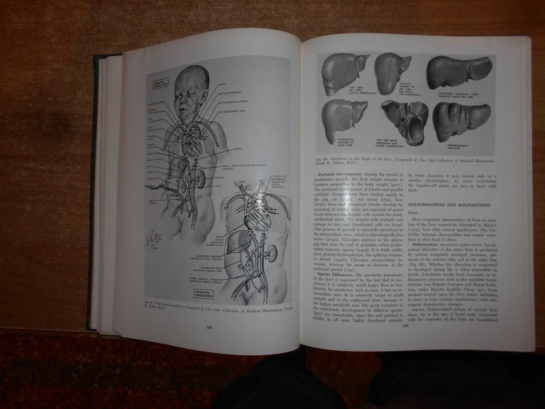 LIVER: STRUCTURE AND FUNCTION. HANS POPPER/FENTON SCHAFFNER 1957