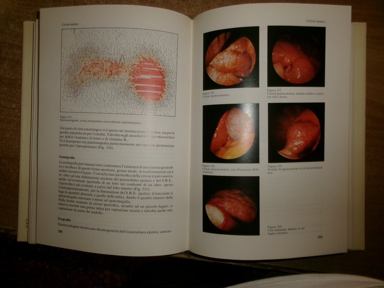 Manuale di Epatologia. P. R. Dal Monte 1982