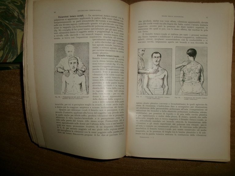 MANUALE di SEMEIOTICA MEDICA. ALFREDO FERRARINI 1950