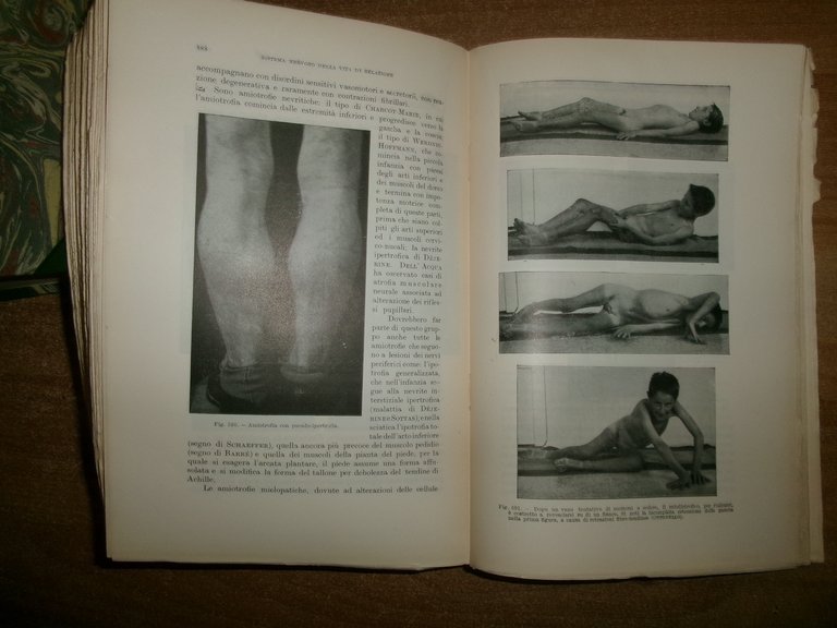 MANUALE di SEMEIOTICA MEDICA. ALFREDO FERRARINI 1950