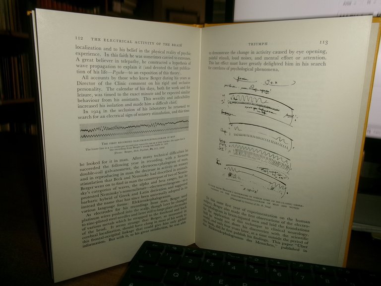MARY A. B. BRAZIER. A History of the Electrical Activity …