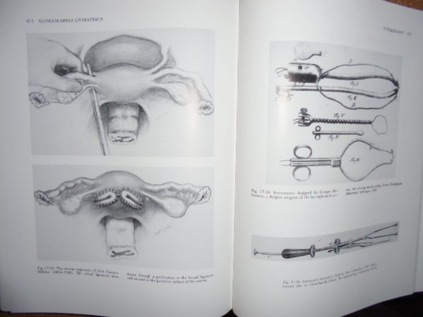 OBSTETRICS AND GYNECOLOGY: A HISTORY AND ICONOGRAPHY. REVISED SECON EDITION …