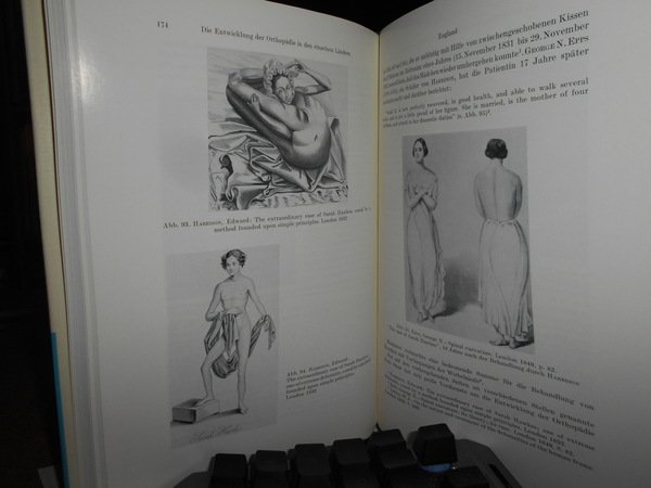 (Ortopedia) Geschichte der Orthopädie
