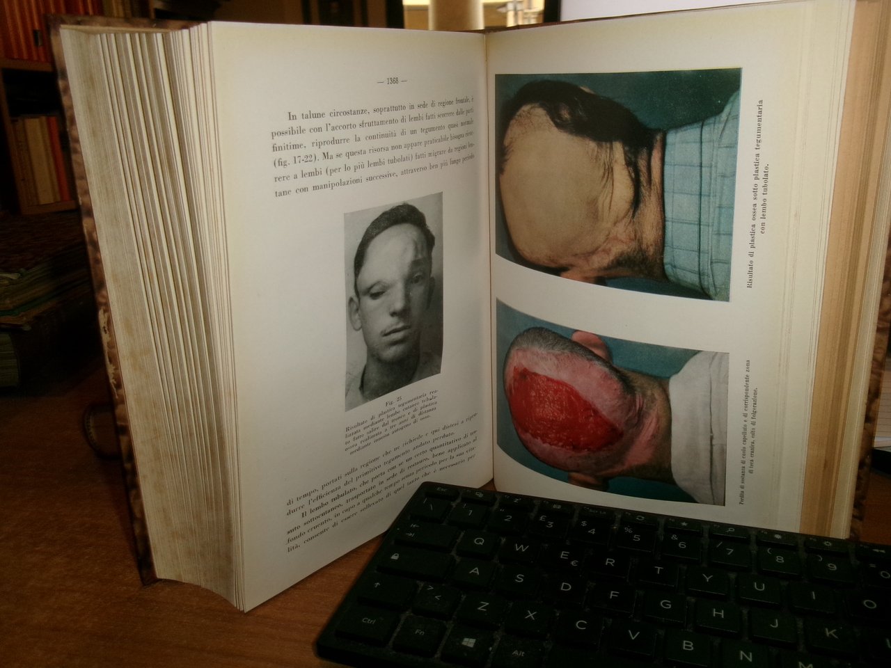 (PARMA) L' Ateneo parmense 1952. Scritti Medici in onore di …