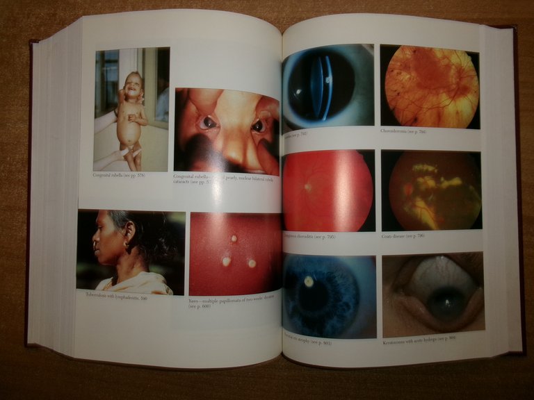 PHYSICIANS' Guide to Rare Diseases second edition. JESS G. THOEME …