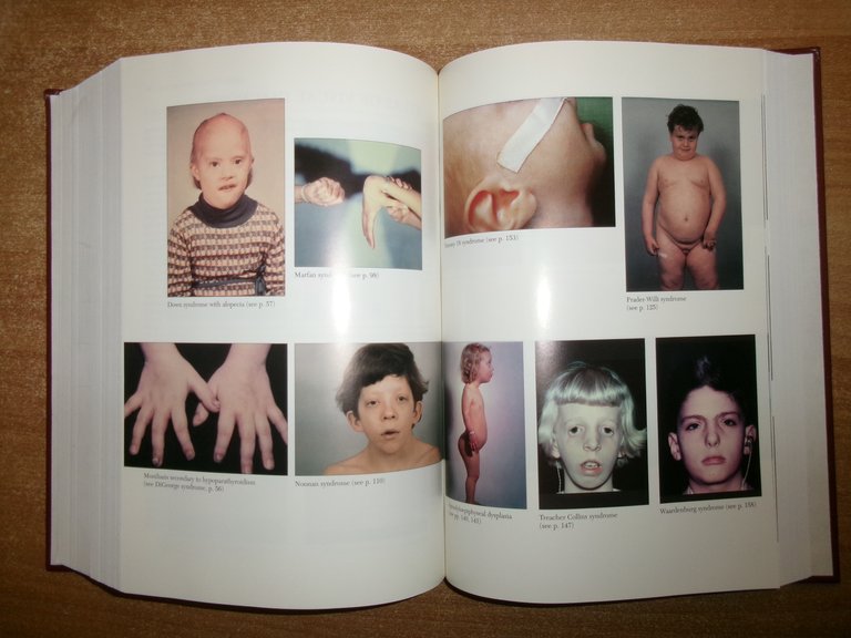 PHYSICIANS' Guide to Rare Diseases second edition. JESS G. THOEME …