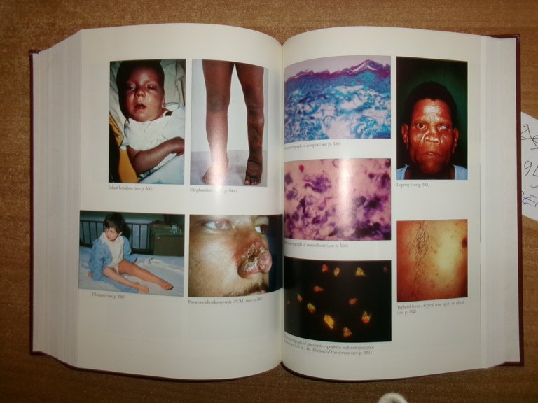 PHYSICIANS' Guide to Rare Diseases second edition. JESS G. THOEME …