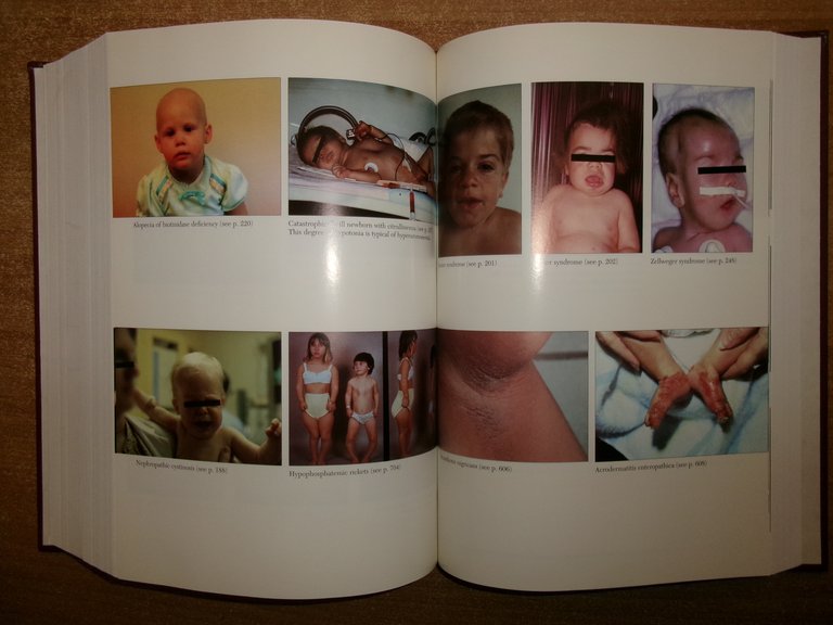 PHYSICIANS' Guide to Rare Diseases second edition. JESS G. THOEME …