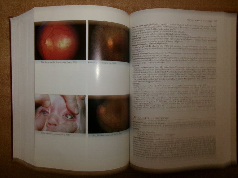 PHYSICIANS' Guide to Rare Diseases second edition. JESS G. THOEME …