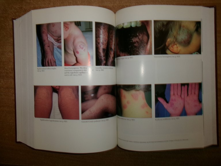 PHYSICIANS' Guide to Rare Diseases second edition. JESS G. THOEME …